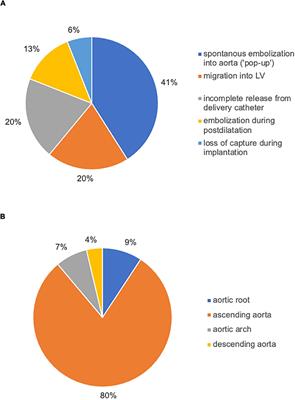 Valve embolization during transcatheter aortic valve implantation: Incidence, risk factors and follow-up by computed tomography